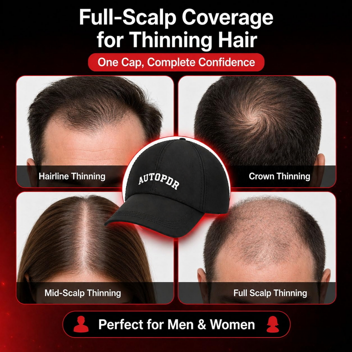 AUTOPDR  Red Light Therapy for Hair Growth,528 Total Light Emitters,Full-Scalp Coverage,Laser Hair Growth Cap for Men & Women,Black