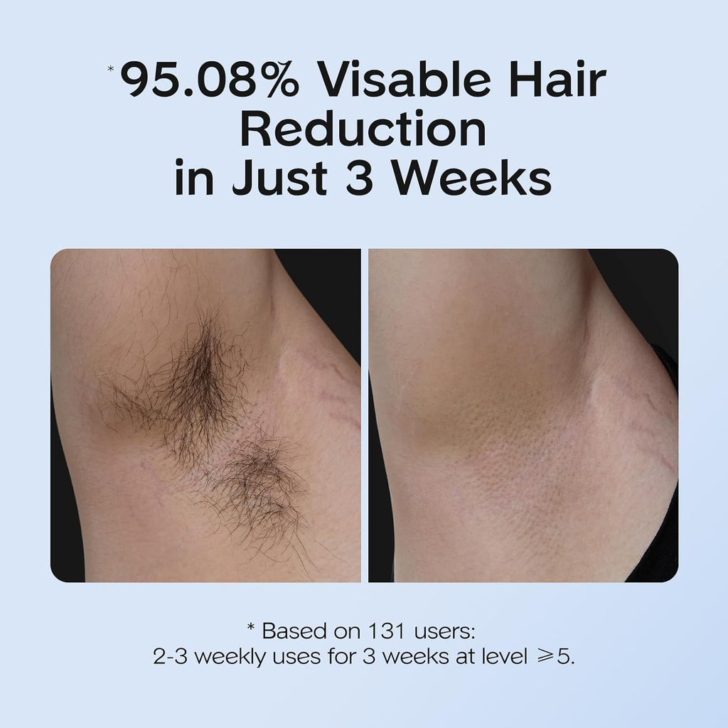 AUTOPDR  Hair Removal with Ice Cooling Care Function for Women,Long-Lasting Results,999,999 Flashes Painless Hair Removal, Hair Removal Device for Armpits Legs Arms Bikini Line